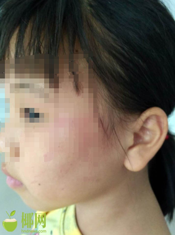 *S‘T’亚太录得7:天4板