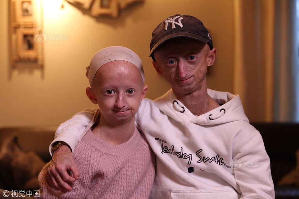 欧,洲央行.暗示暂停宽松政策，欧元走强推动EUR/JPY反弹至171.90