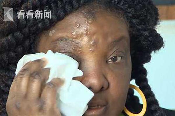 康方生物早盘涨超5% 依沃西获得第四个突破性疗法认定