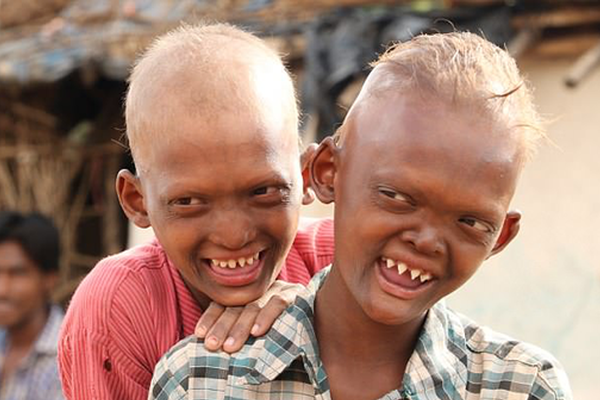 详?解苏州银行2025中报：规模稳健高增、息差环比企稳【中泰银行·戴志锋/邓美君/马志豪】