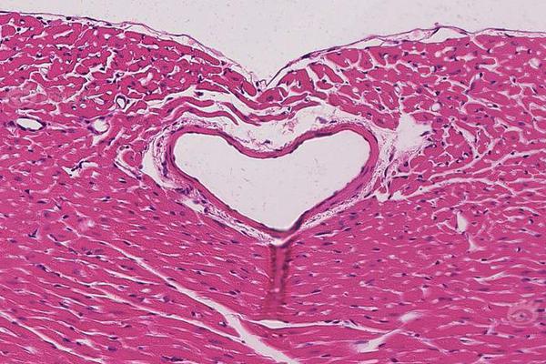 山东黄金补缴税款7.‘3’8亿元.！补税5.08亿+滞纳金2.3亿