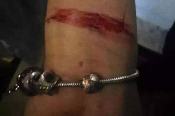 古越龙—山已回购18<3>5万股 金额1.86亿元