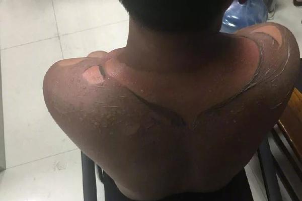 广汽埃安7月销量265<5>7辆!