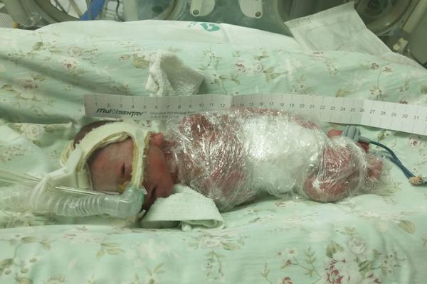 眼;科市场争夺战:复宏汉霖报产，罗氏、诺华、信达等“进口+国产”战况焦灼