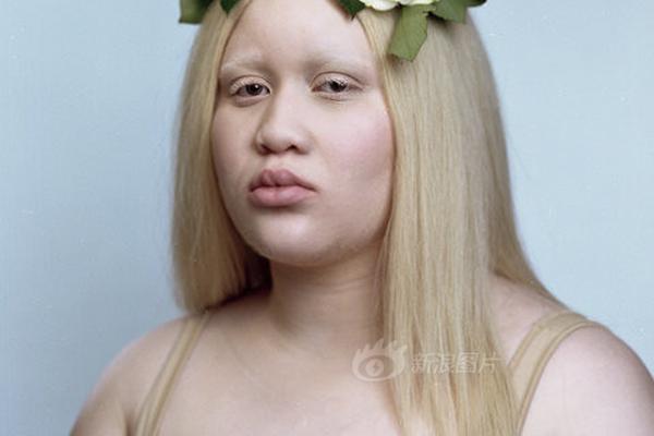 消费股，全‘面’爆发！知?名价投大V：好多年没涨停，泪流满面