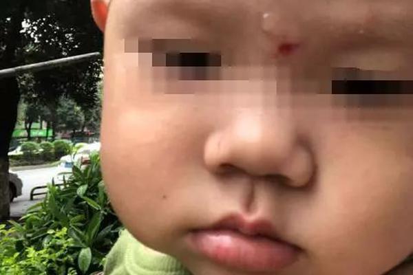 同:源康医药-B高开逾6% 与四川汇宇就TY-9591订立潜在总代理协议